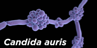 CDC says drug-resistant ‘superbug’ fungus seen among patients in D.C., Texas