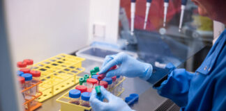 37% of COVID-19 Patients Diagnosed With A Long-COVID Symptom- Oxford study