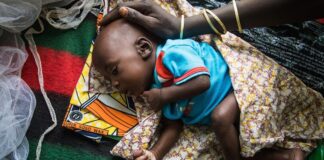 Over 7 million children in the Horn of Africa under the age of 5 remain malnourished- UNICEF