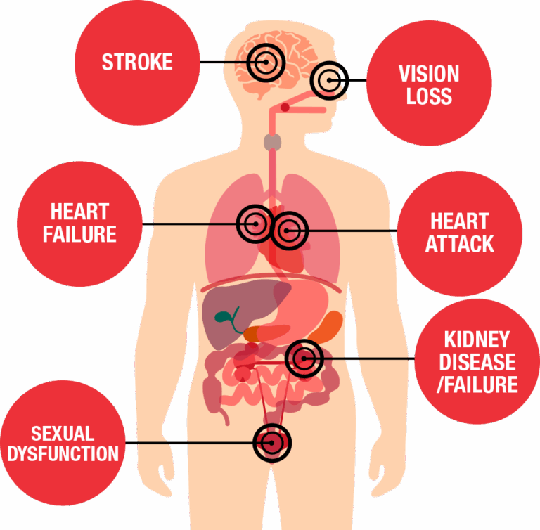 Understanding High Blood Pressure: A Silent Threat to Your Health