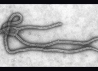 Kenya Confirms 4 New Ebola Cases, Total Rises to 7